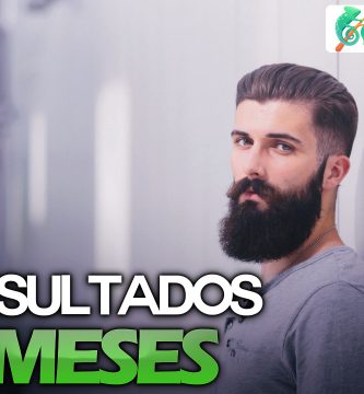 Resultado de 3 meses usando Minoxidil